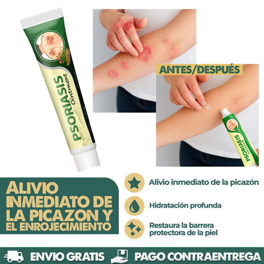 Eczema & Psoriasis Cream | Dile adiós a la irritación y molestias